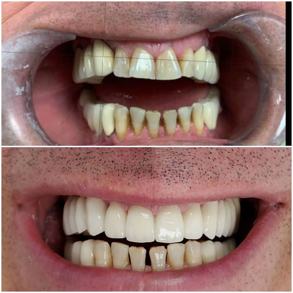 ____klinike-dentare-tirane-122