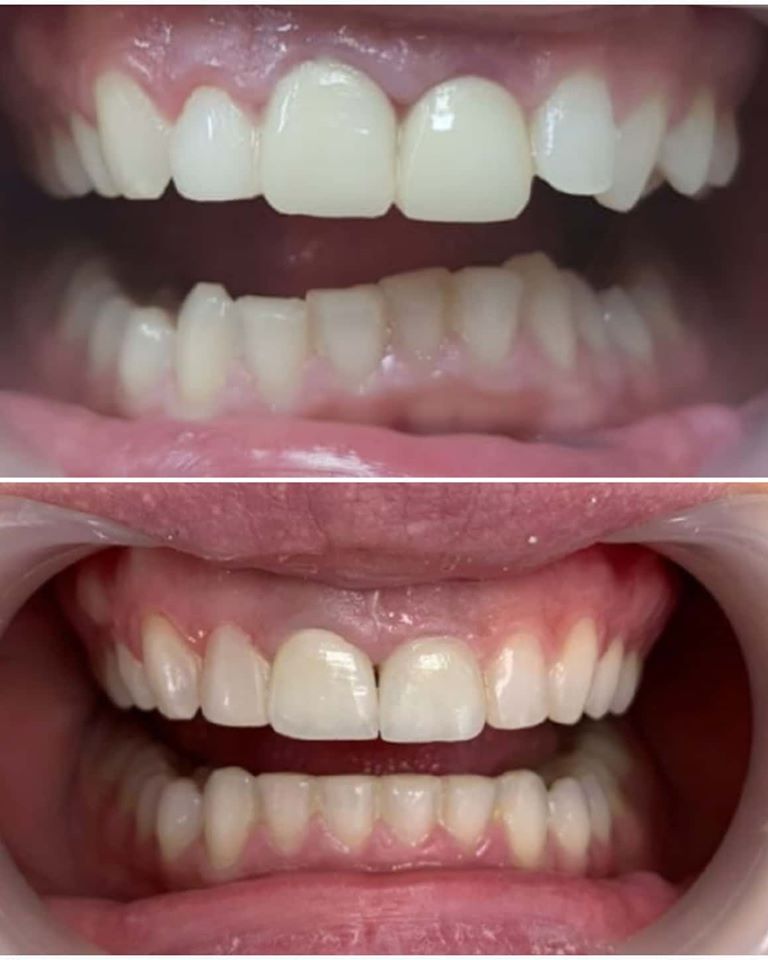 ____klinike-dentare-tirane-16