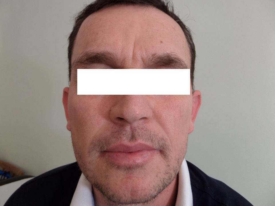 0-0-0-0-0-0-0-klinika-stroka-trajtim-nishani-trajtim-i-kancerit-te-lekures-14 0-0-0-0-0-0-0-klinika-stroka-trajtim-nishani-trajtim-i-kancerit-te-lekures-14