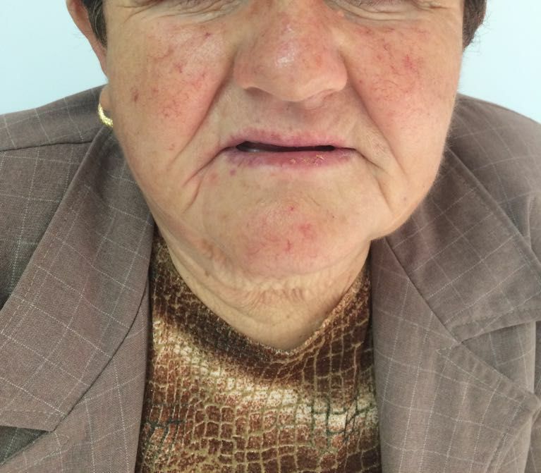 0-0-0-0-0-0-0-klinika-stroka-trajtim-nishani-trajtim-i-kancerit-te-lekures-4 0-0-0-0-0-0-0-klinika-stroka-trajtim-nishani-trajtim-i-kancerit-te-lekures-4