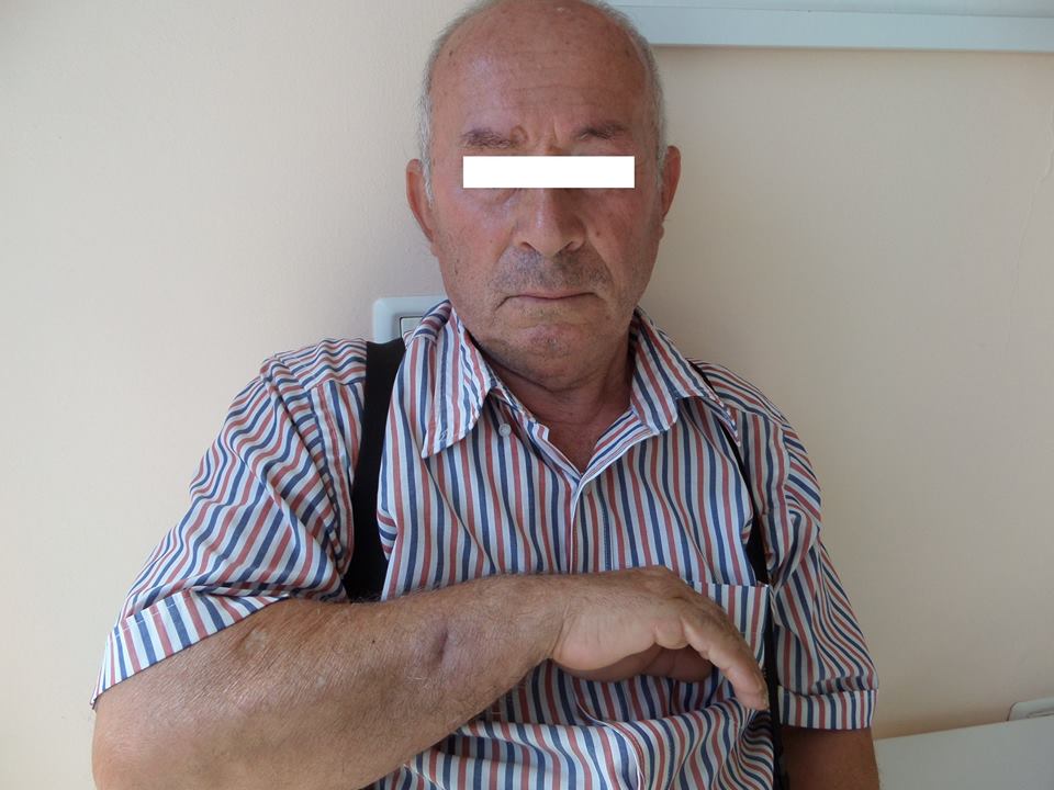 0-0-0-0-0-0-0-klinika-stroka-trajtim-nishani-trajtim-i-kancerit-te-lekures-6 0-0-0-0-0-0-0-klinika-stroka-trajtim-nishani-trajtim-i-kancerit-te-lekures-6