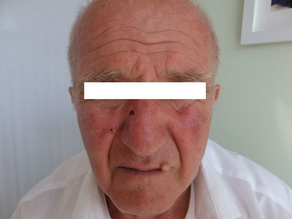 0-0-0-0-0-0-0-klinika-stroka-trajtim-nishani-trajtim-i-kancerit-te-lekures-7 0-0-0-0-0-0-0-klinika-stroka-trajtim-nishani-trajtim-i-kancerit-te-lekures-7