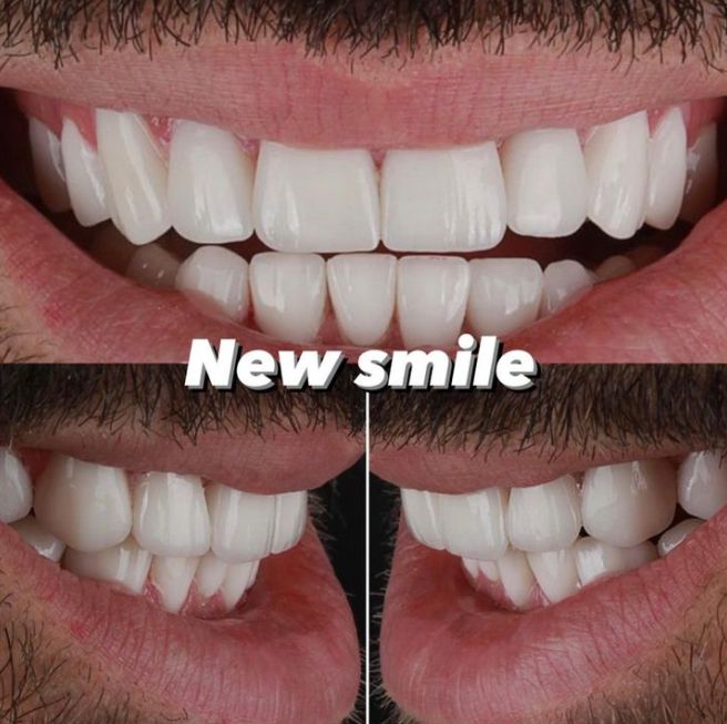 ___klinike-dentare-komuna-parisit-120