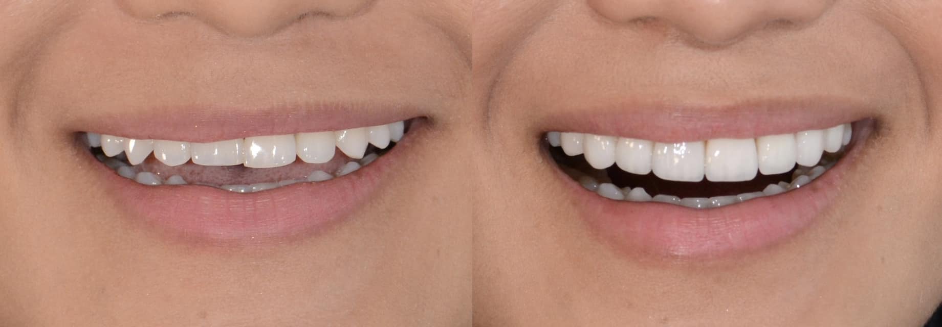 ___klinike-dentare-komuna-parisit-14