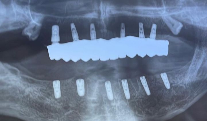 ___klinike-dentare-komuna-parisit-193