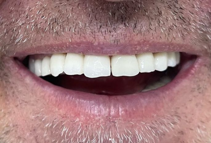 ___klinike-dentare-komuna-parisit-194