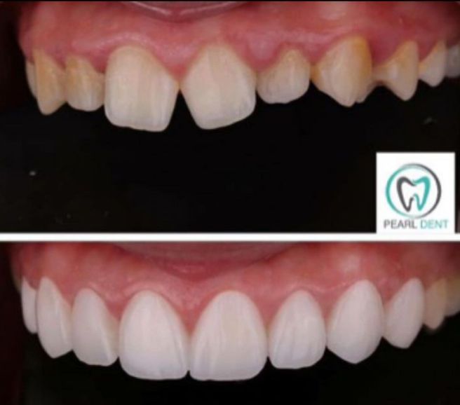astir-dentiste-13