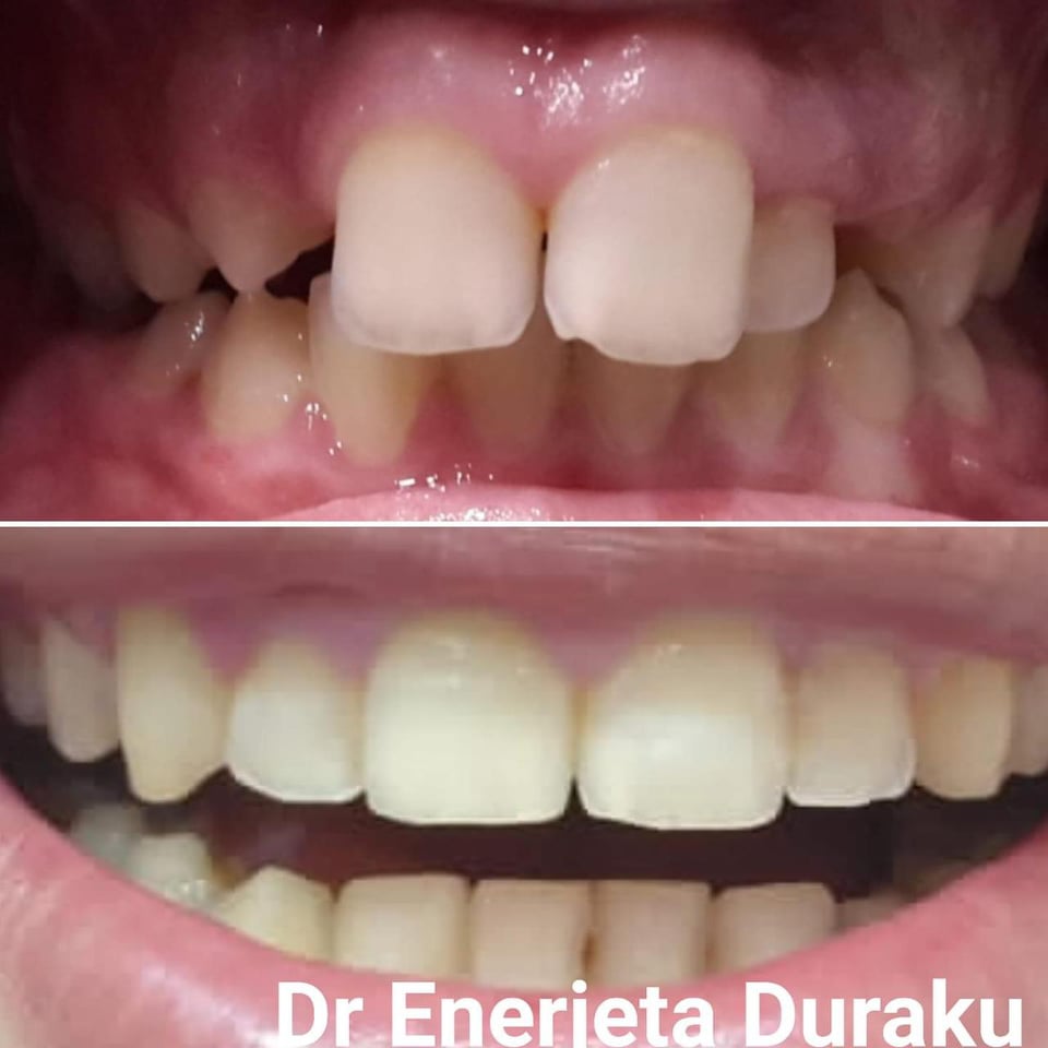 ______________________klinike-dentare-dentist-berat-19