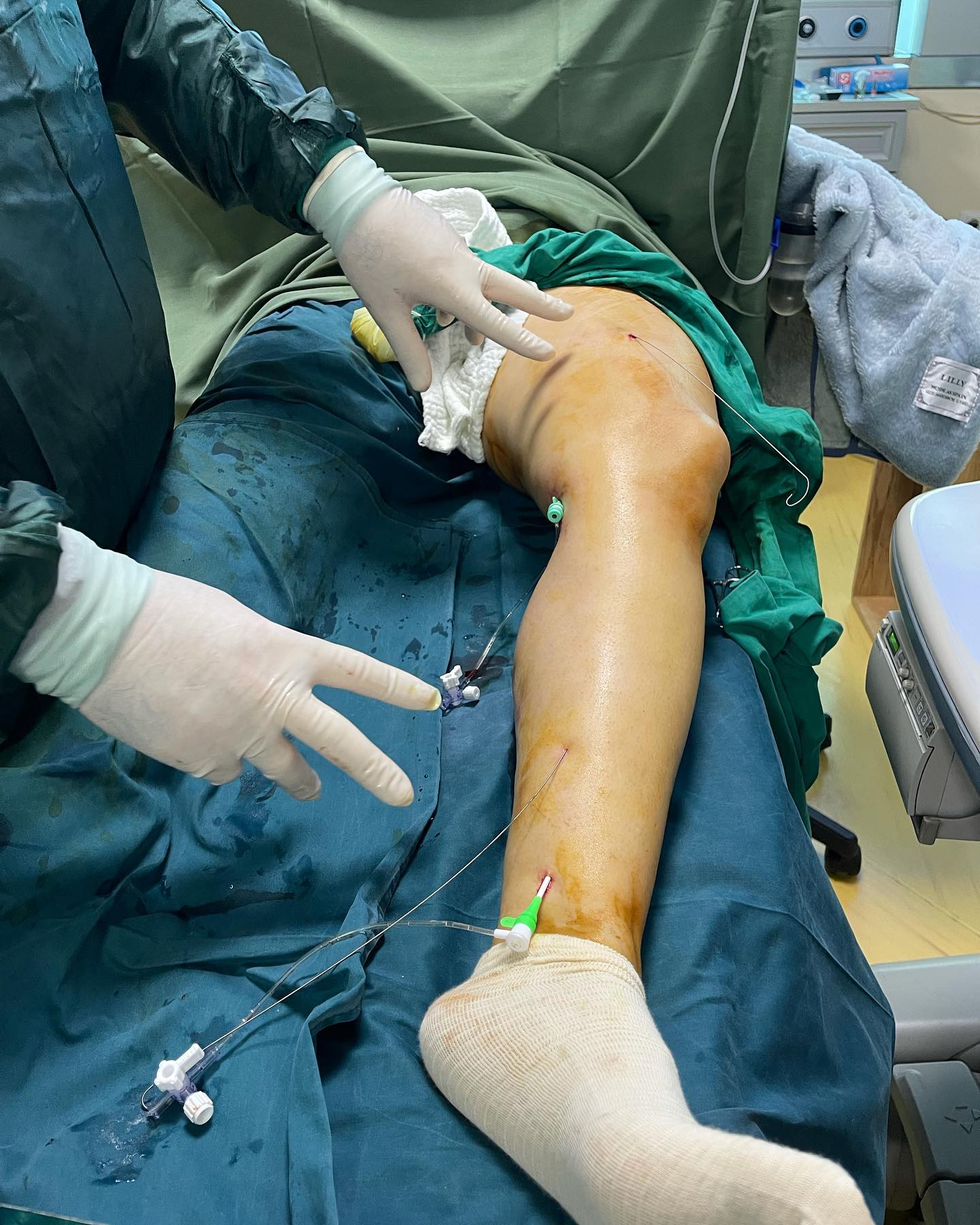 _____Kardiolog-i-mire-tirane-berat-131