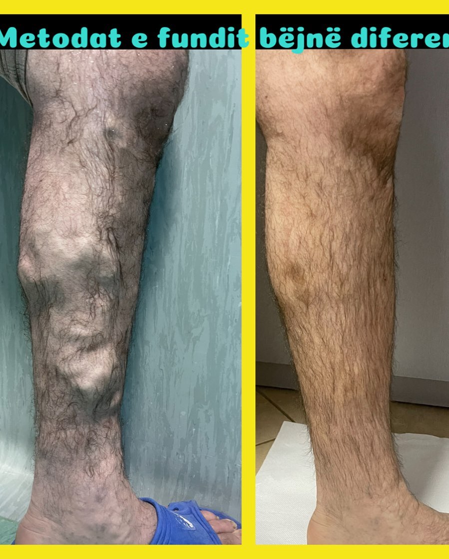 _____Kardiolog-i-mire-tirane-berat-17