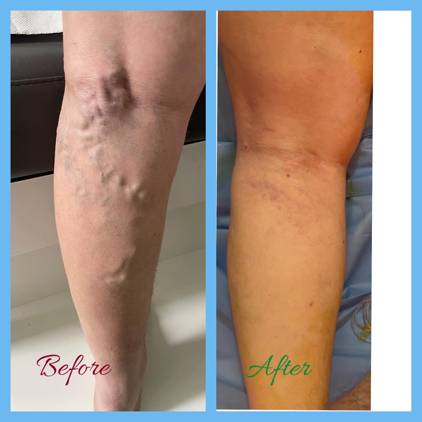 _____Kardiolog-i-mire-tirane-berat-18