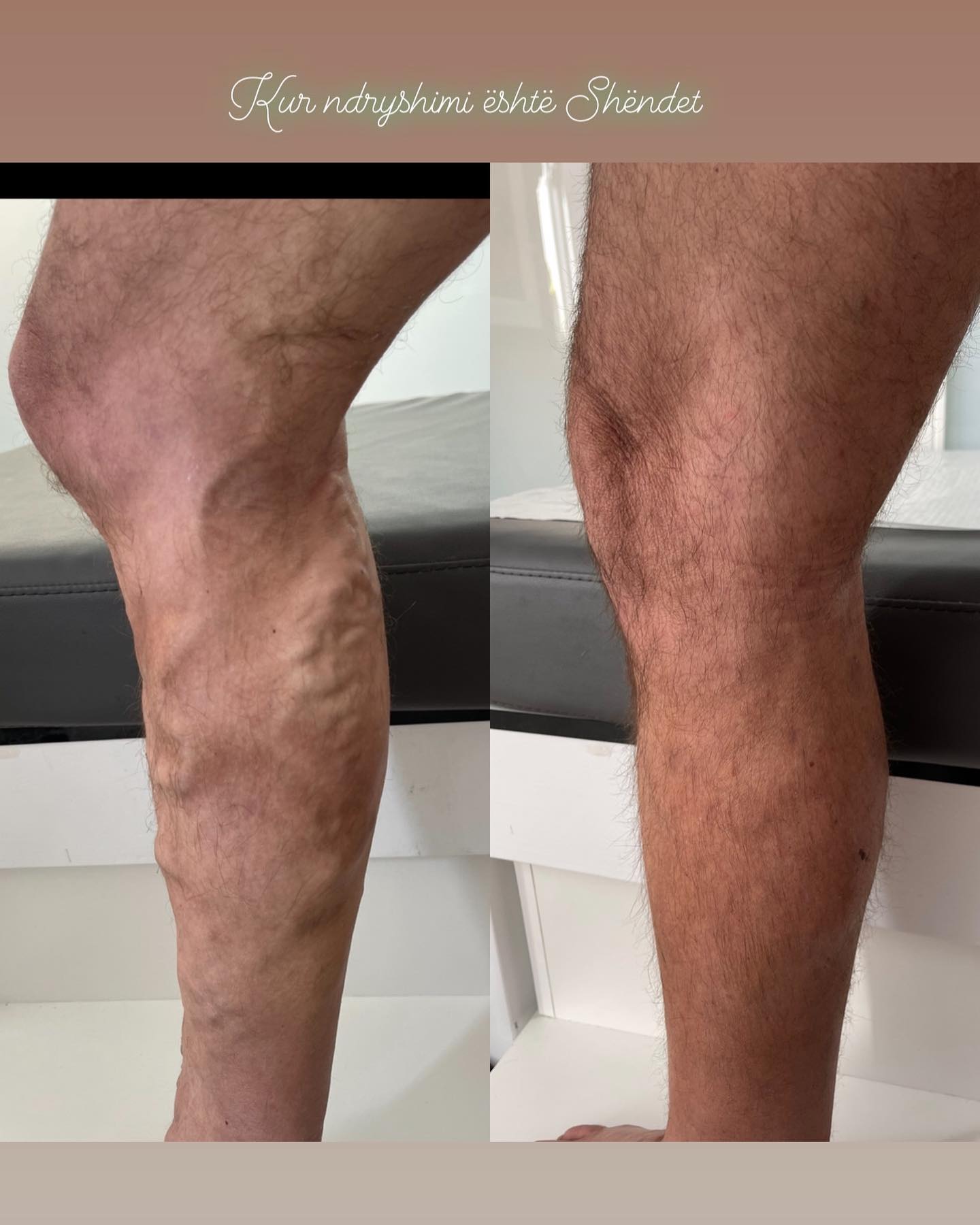 _____Kardiolog-i-mire-tirane-berat-19