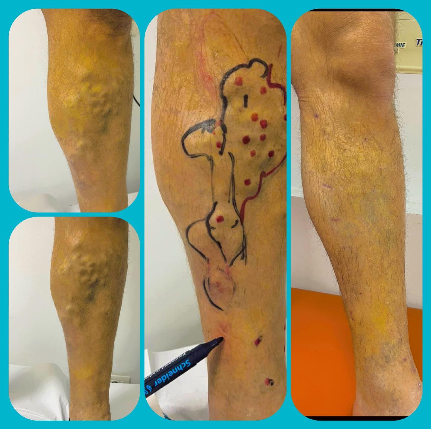 _____Kardiolog-i-mire-tirane-berat-191