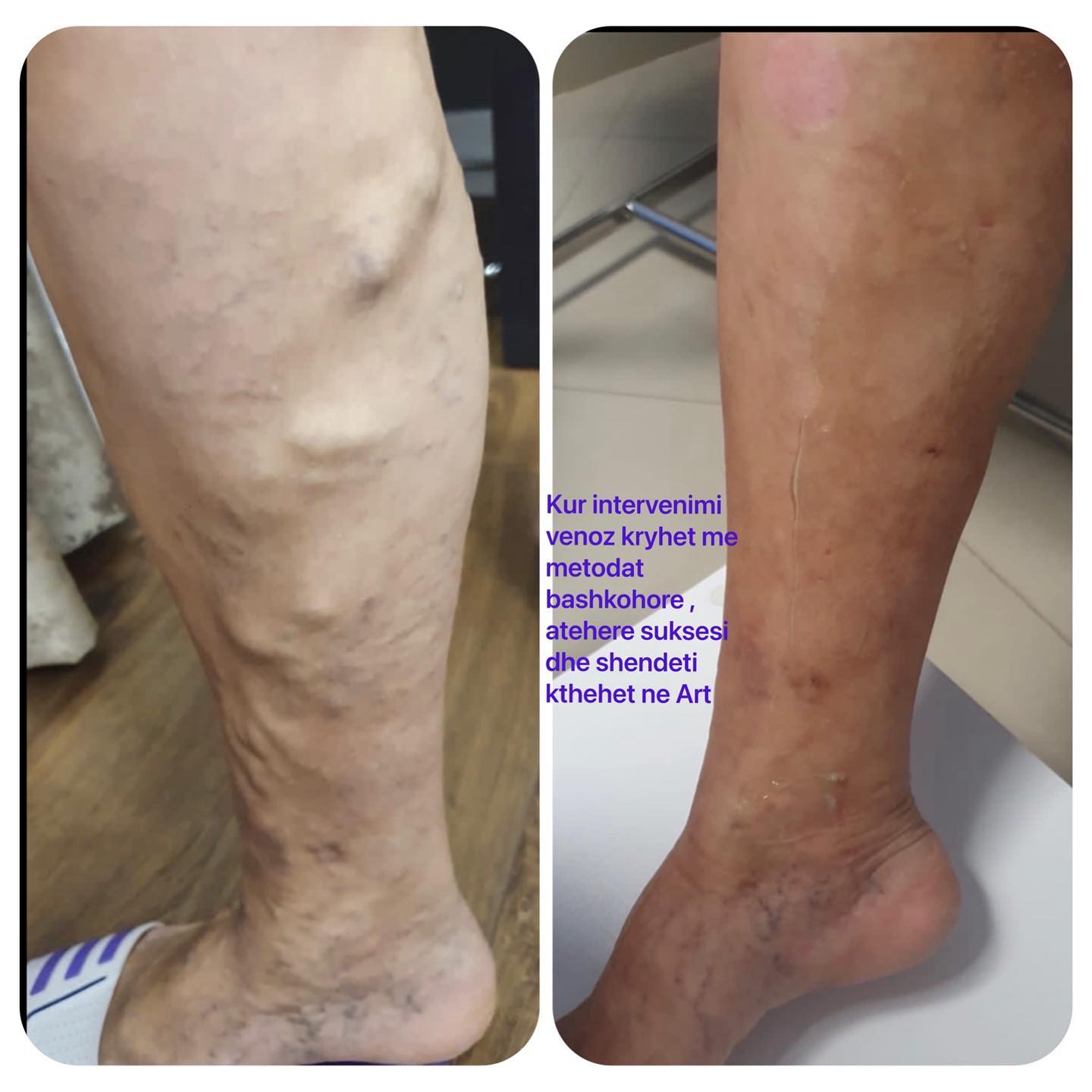 _____Kardiolog-i-mire-tirane-berat-193