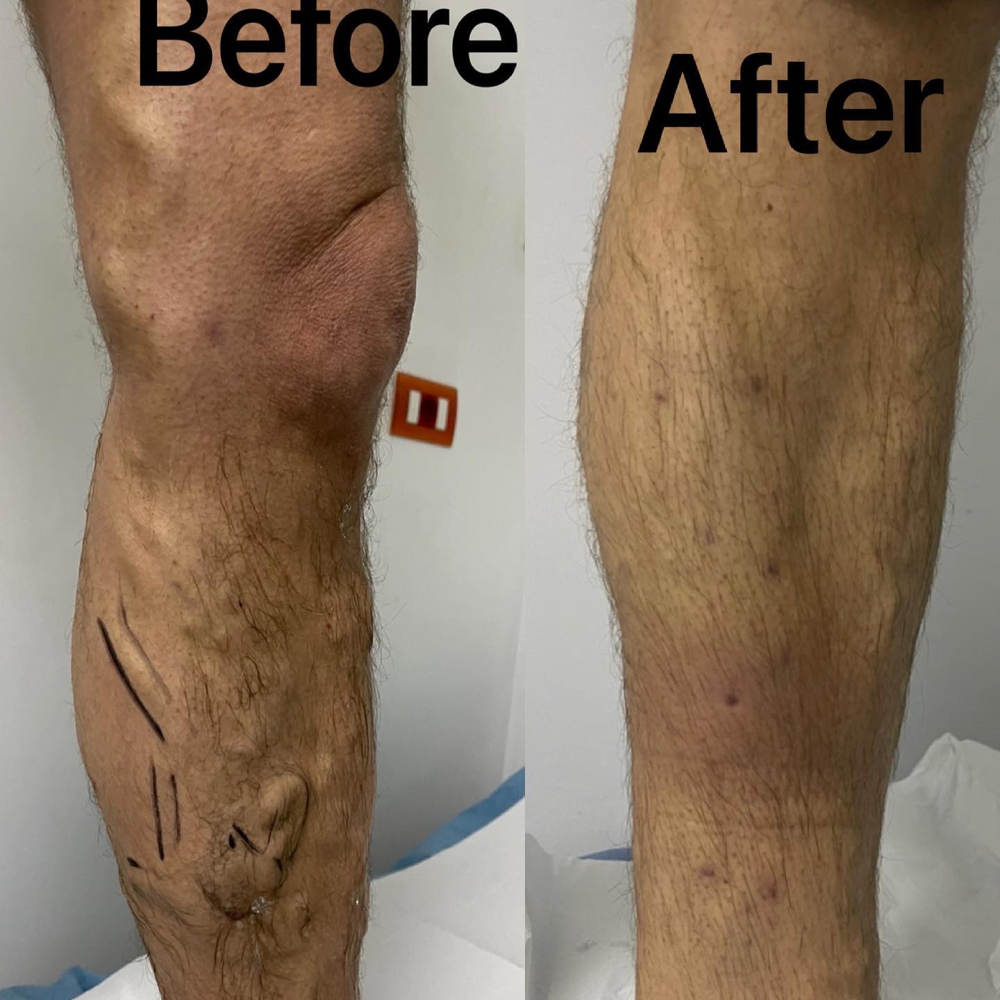 _____Kardiolog-i-mire-tirane-berat-194