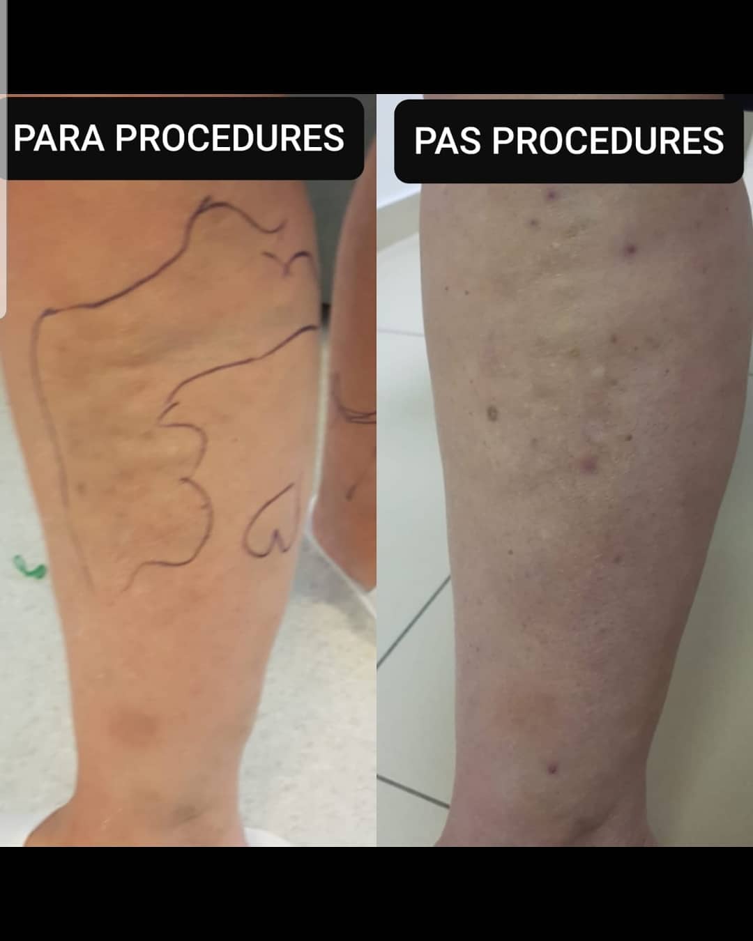 _____Kardiolog-i-mire-tirane-berat-195