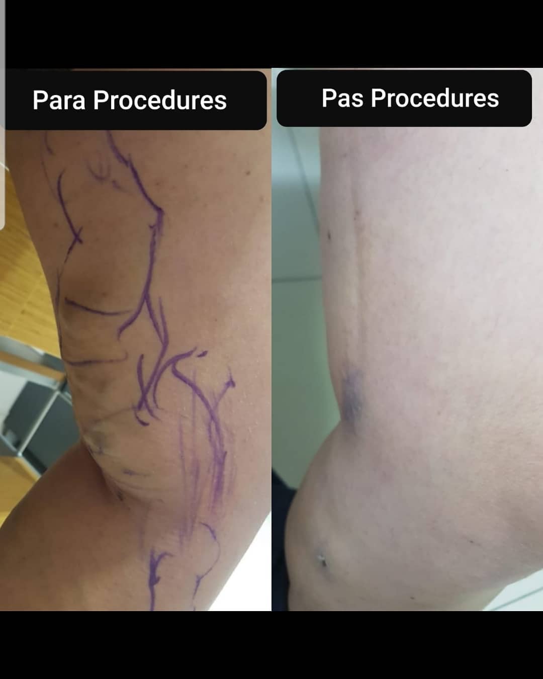 _____Kardiolog-i-mire-tirane-berat-197