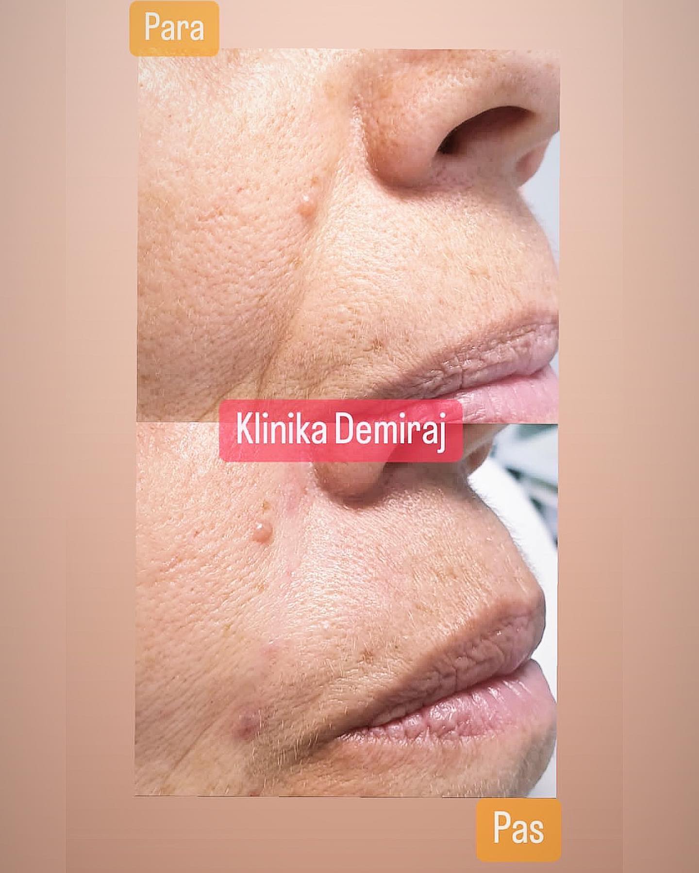 Dermatologe-durres-klinike-1