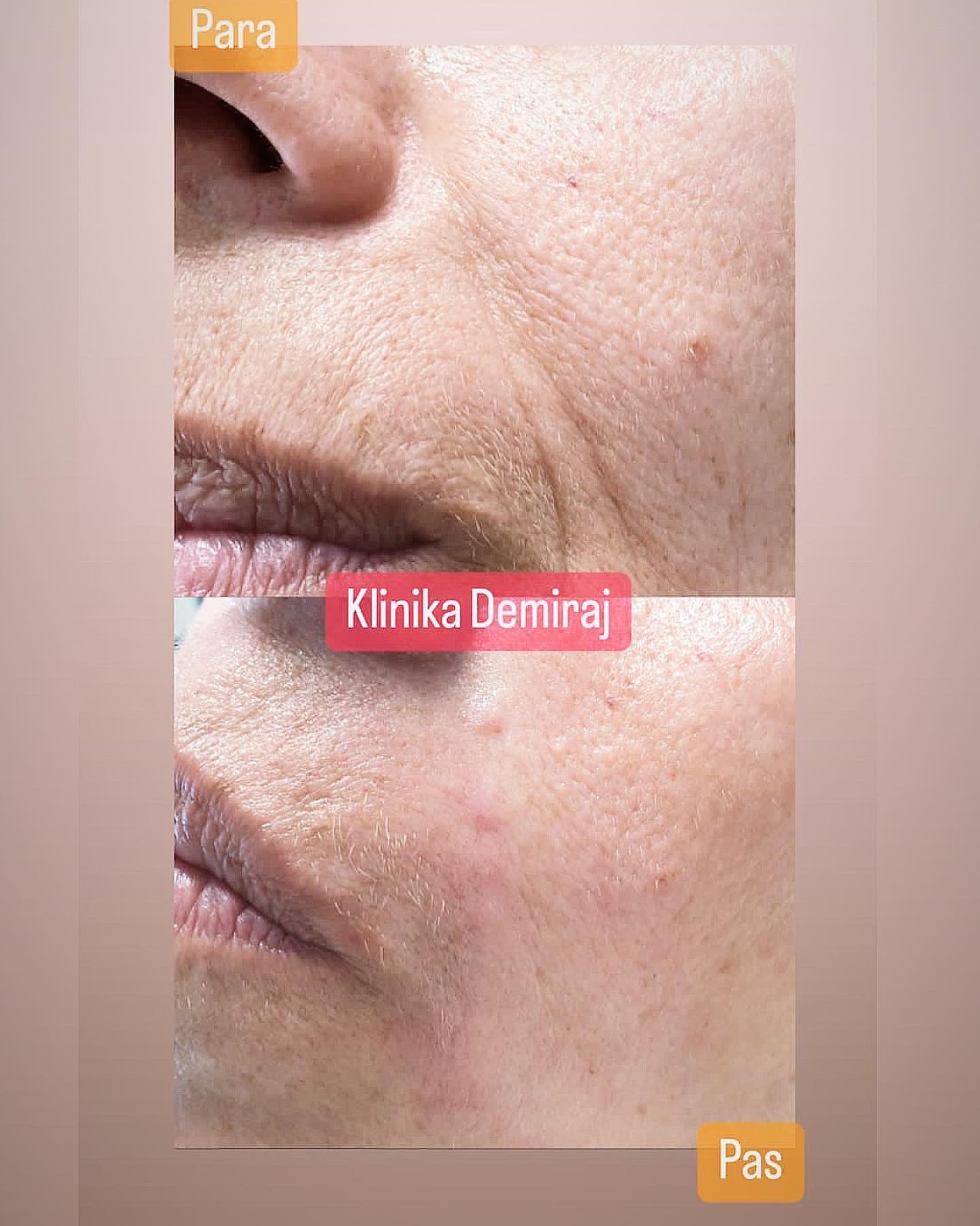 Dermatologe-durres-klinike-11