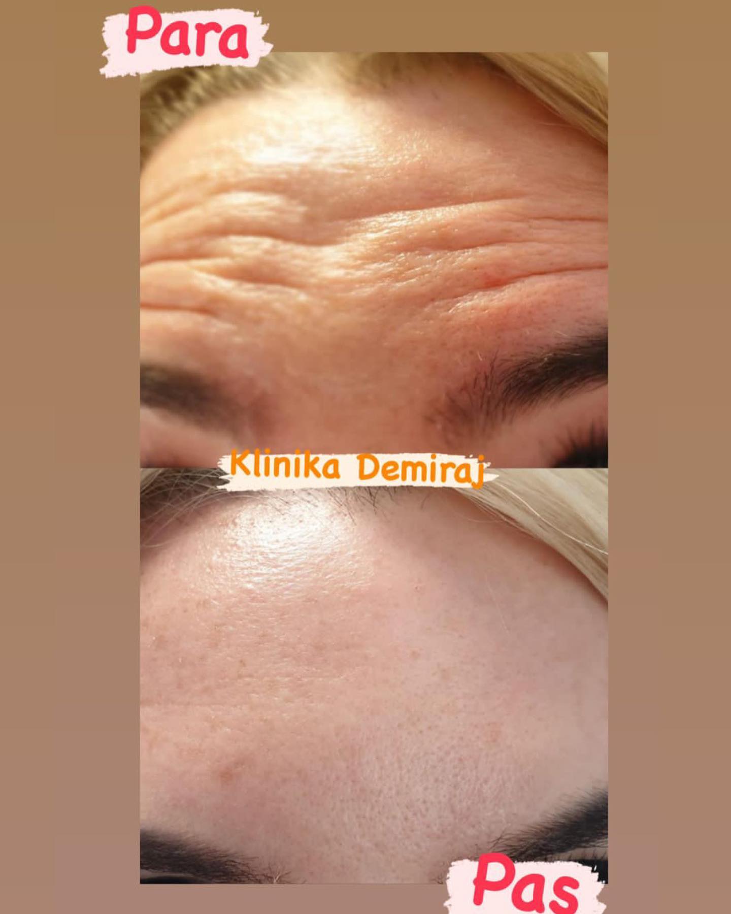 Dermatologe-durres-klinike-12