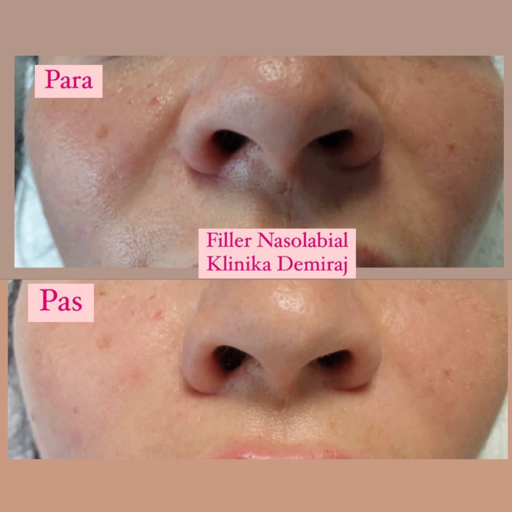 Dermatologe-durres-klinike-13
