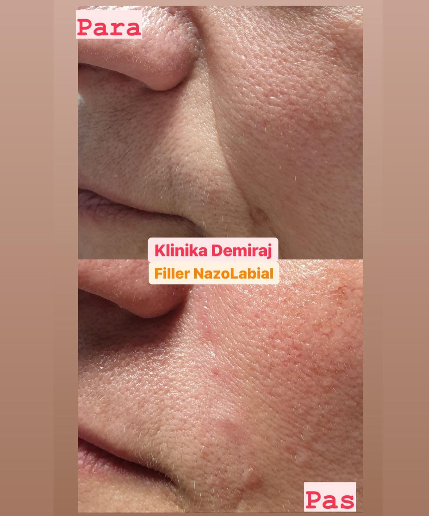 Dermatologe-durres-klinike-130
