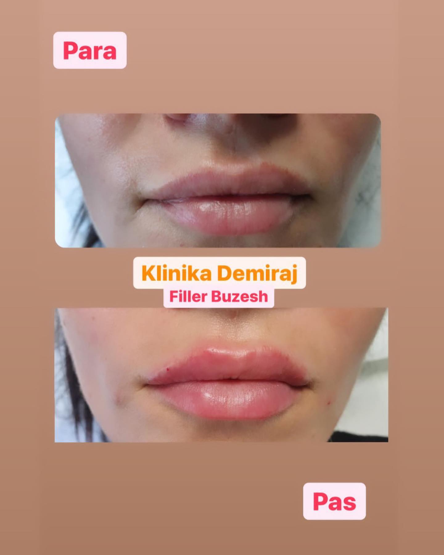 Dermatologe-durres-klinike-14