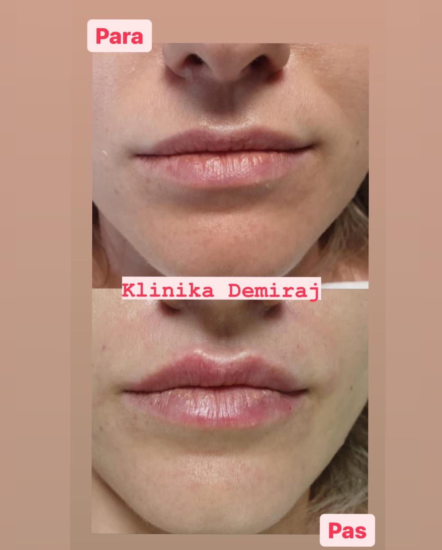 Dermatologe-durres-klinike-141