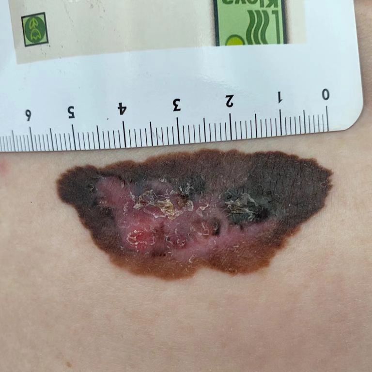 Dermatologe-durres-klinike-19