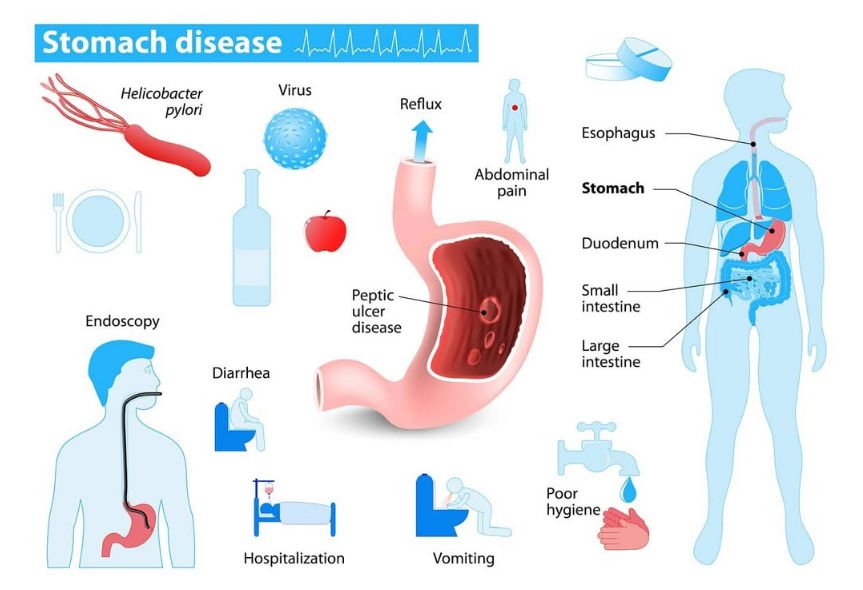 STOMAKUN-KLINIKE-GASTRO-TIRANE-193