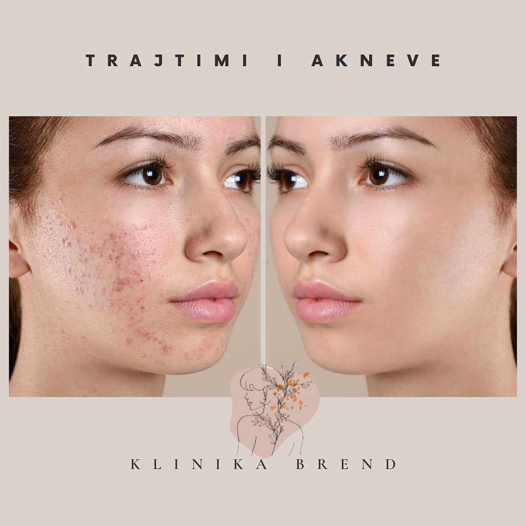dermatologe-tirane-klinika-12