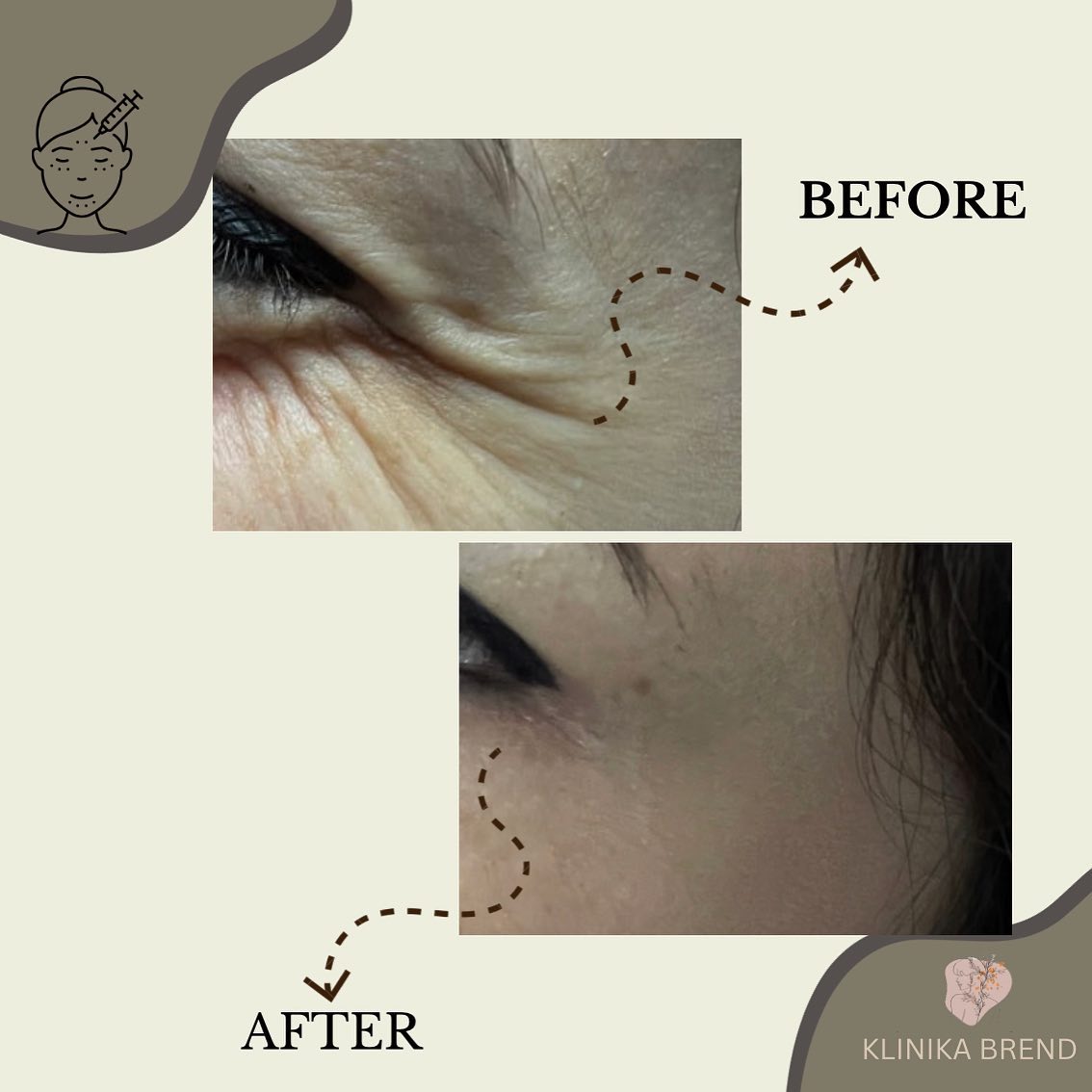 dermatologe-tirane-klinika-14