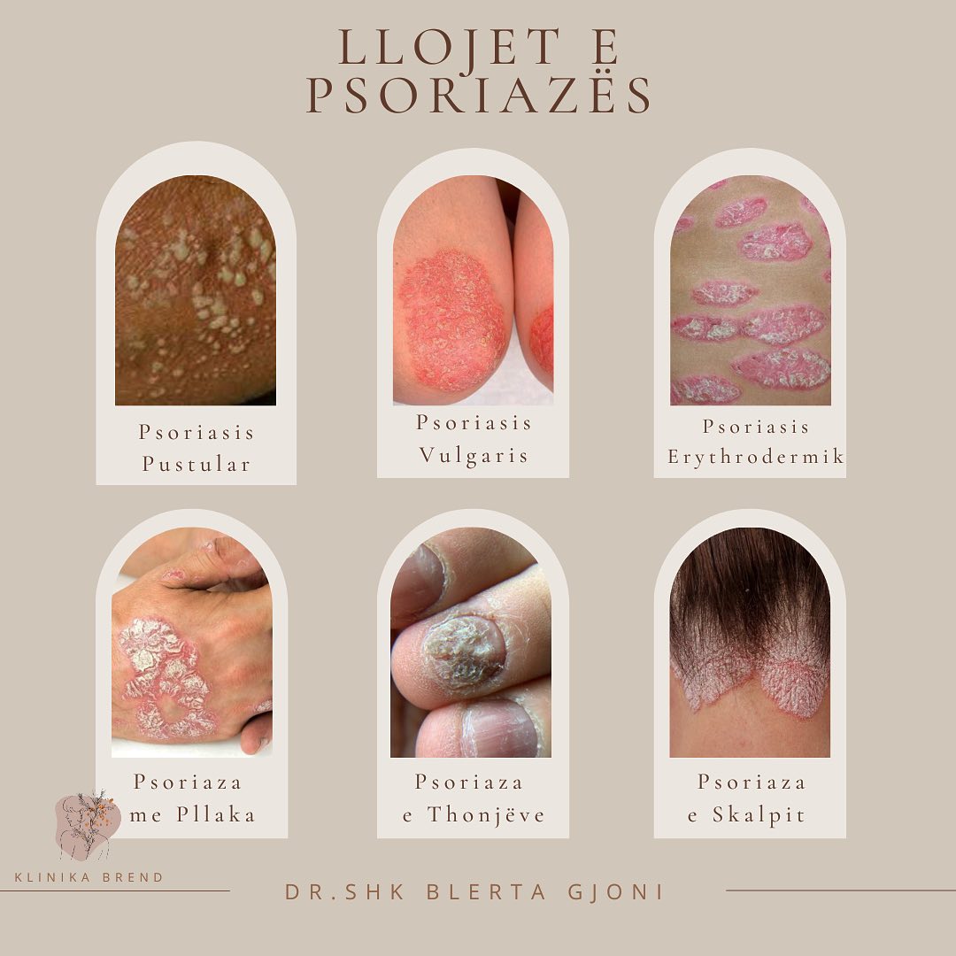 dermatologe-tirane-klinika-15