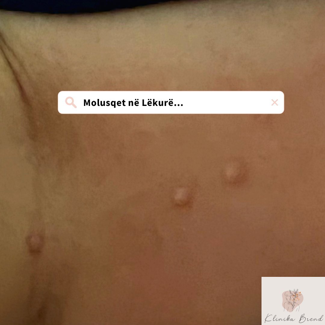 dermatologe-tirane-klinika-18