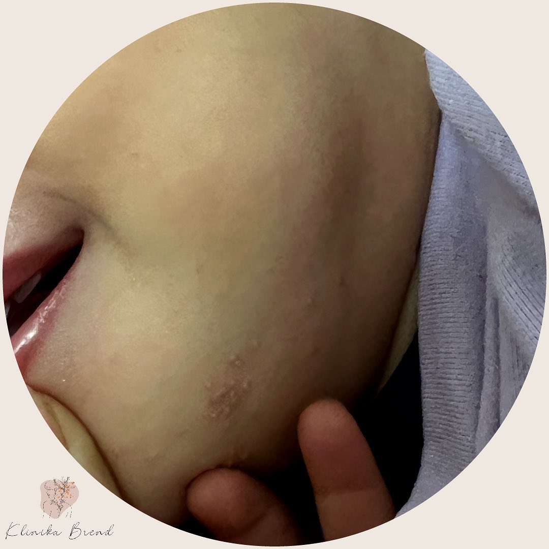 dermatologe-tirane-klinika-19