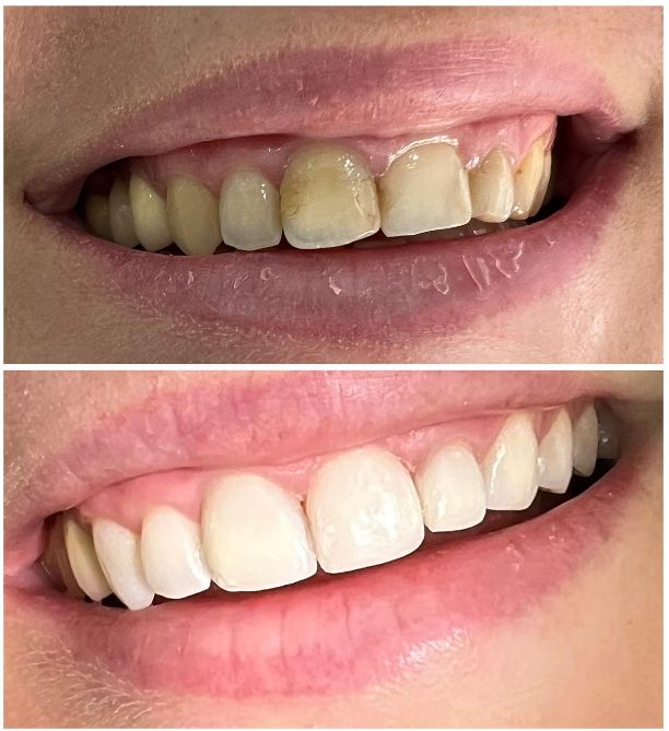 _dentist-klinike-dentare-dures-15