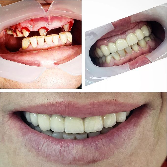 _dentist-klinike-dentare-dures-18