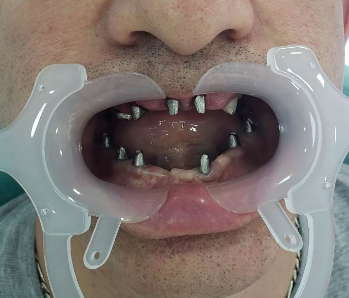 _dentist-klinike-dentare-dures-181