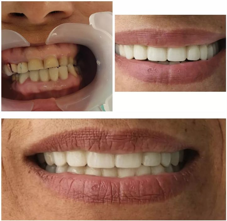 _dentist-klinike-dentare-dures-185