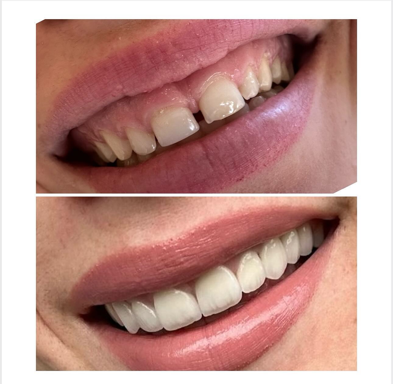 ________ASTIR-KLINIKE-DENTARE-DENTIST-15