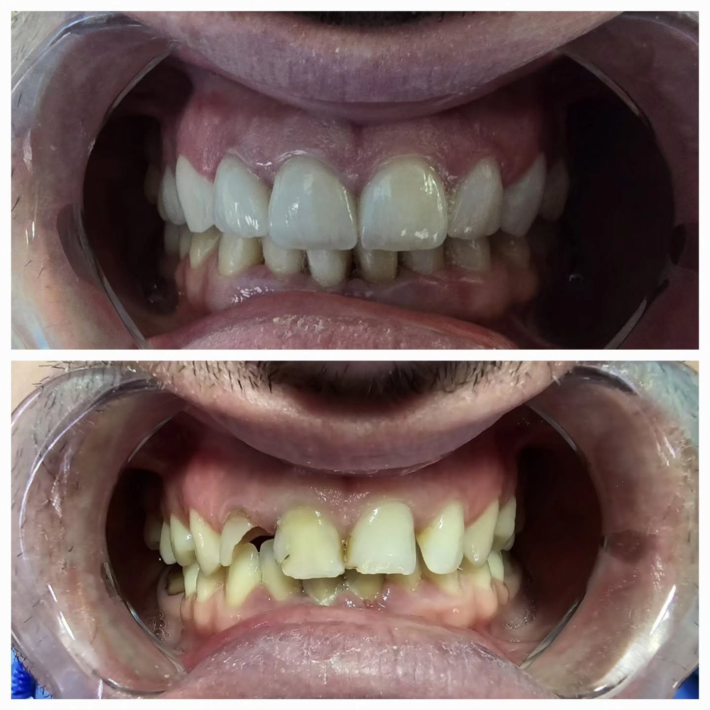 ________ASTIR-KLINIKE-DENTARE-DENTIST-17