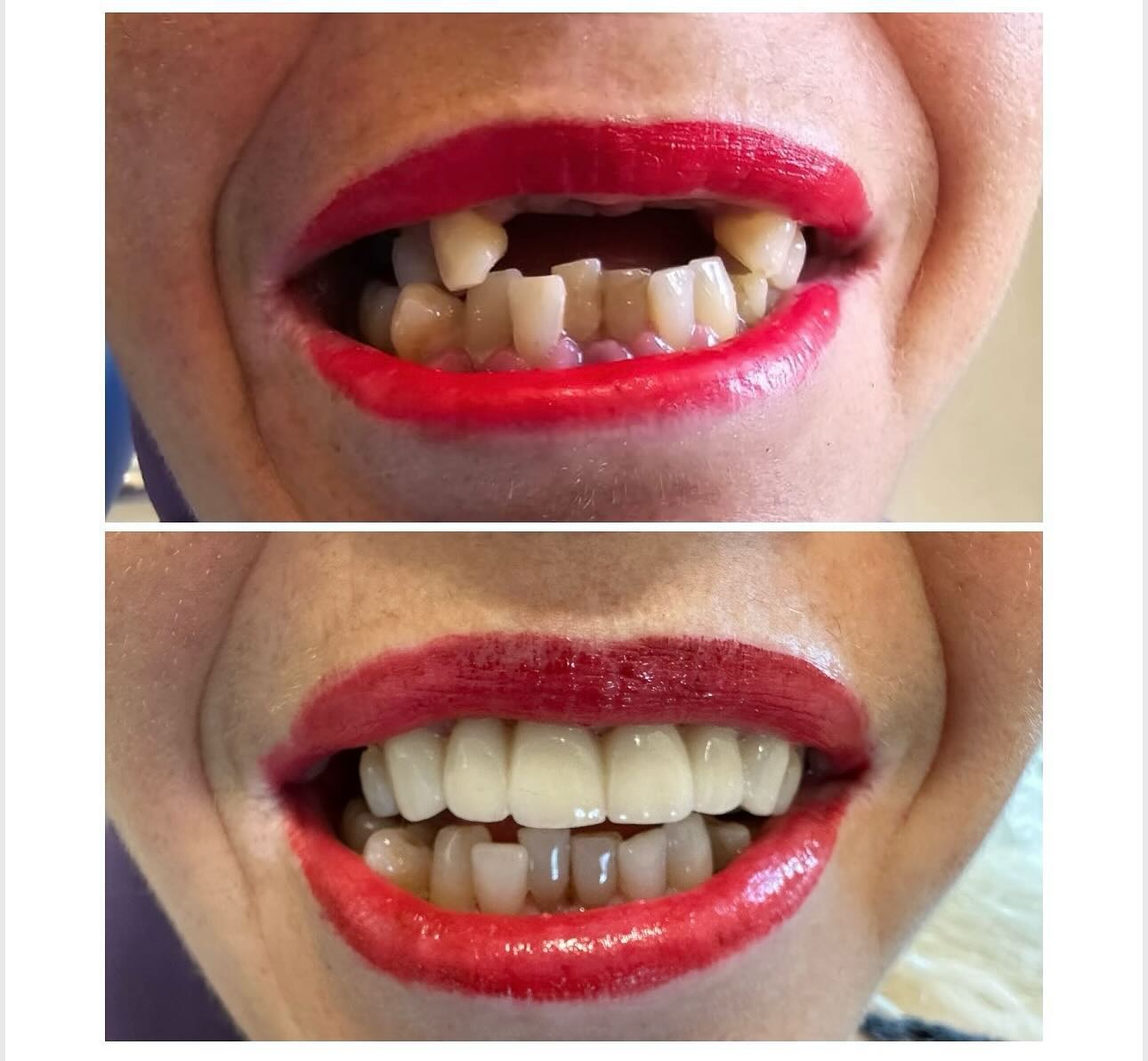 ________ASTIR-KLINIKE-DENTARE-DENTIST-18