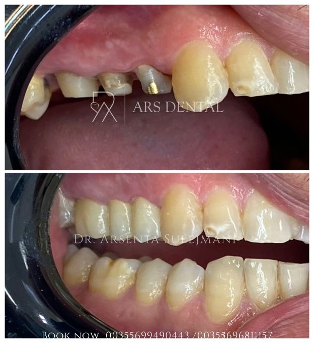 _________________________dentist-klinika-durres-17