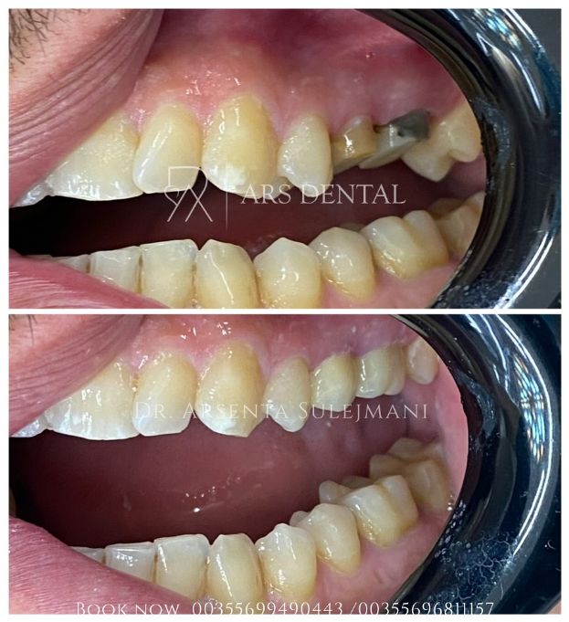 _________________________dentist-klinika-durres-18