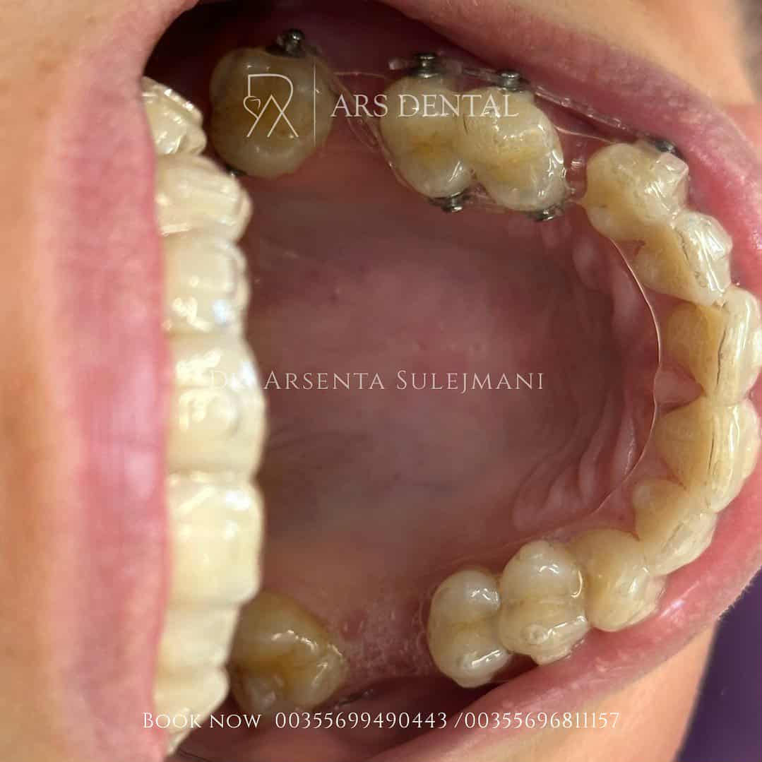 _________________________dentist-klinika-durres-19