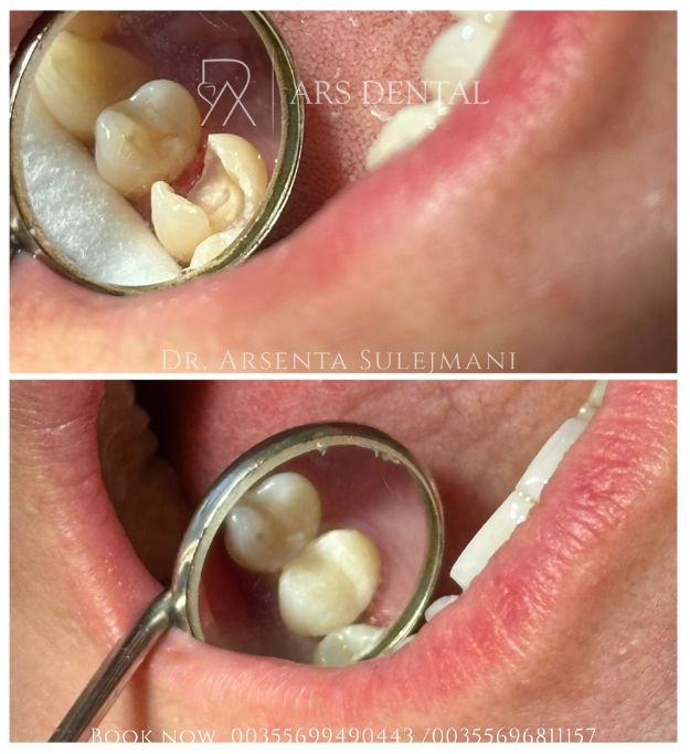 _________________________dentist-klinika-durres-190