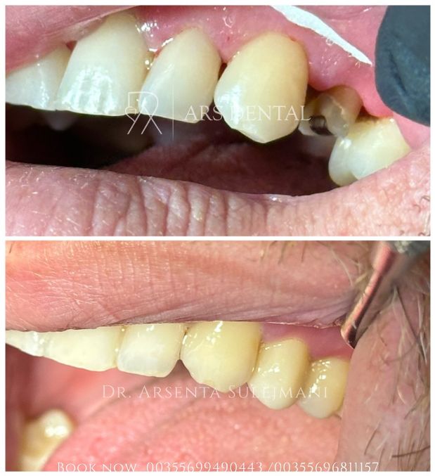 _________________________dentist-klinika-durres-192