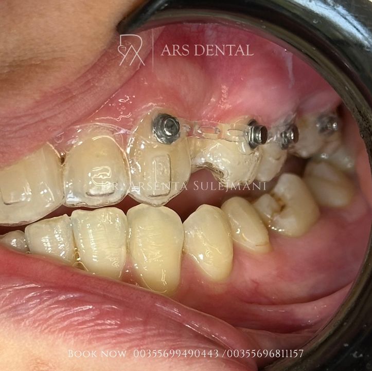 _________________________dentist-klinika-durres-194