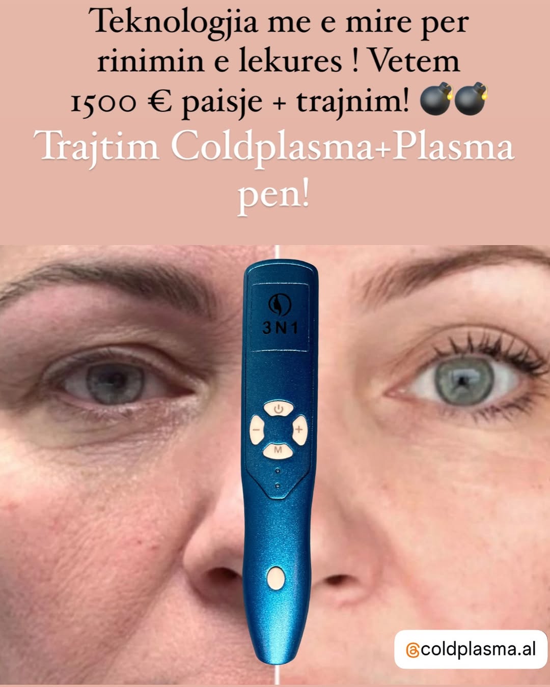 ___trajtim-me-plazem-shkoder-estetike-1