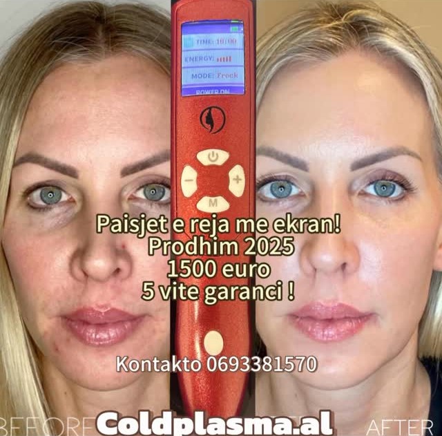___trajtim-me-plazem-shkoder-estetike-11